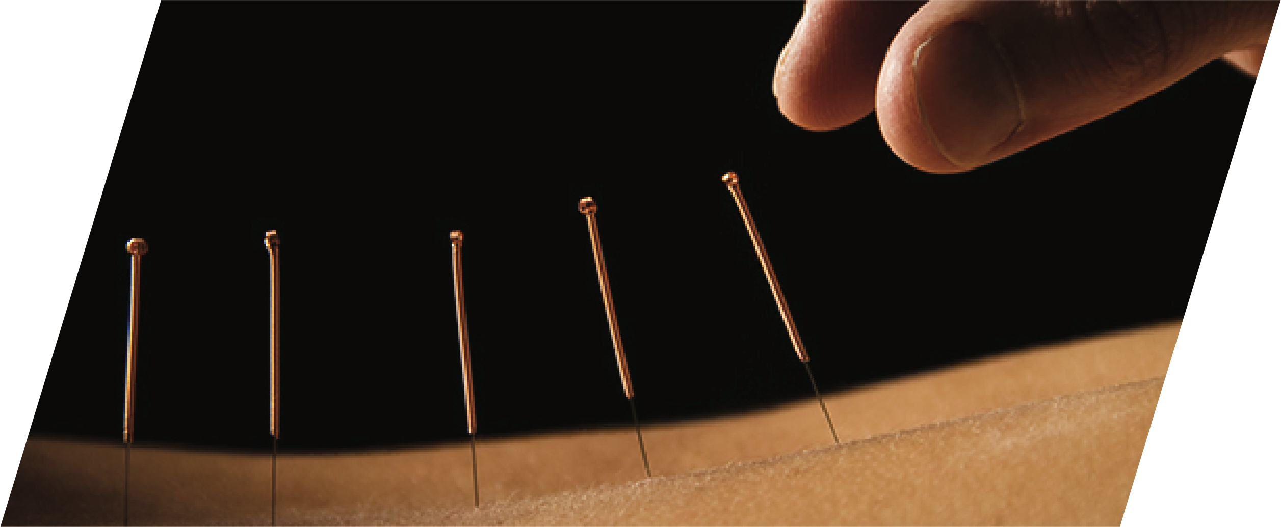 chinese-acupuncture-header